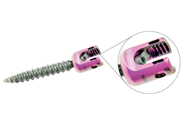 Screw Options